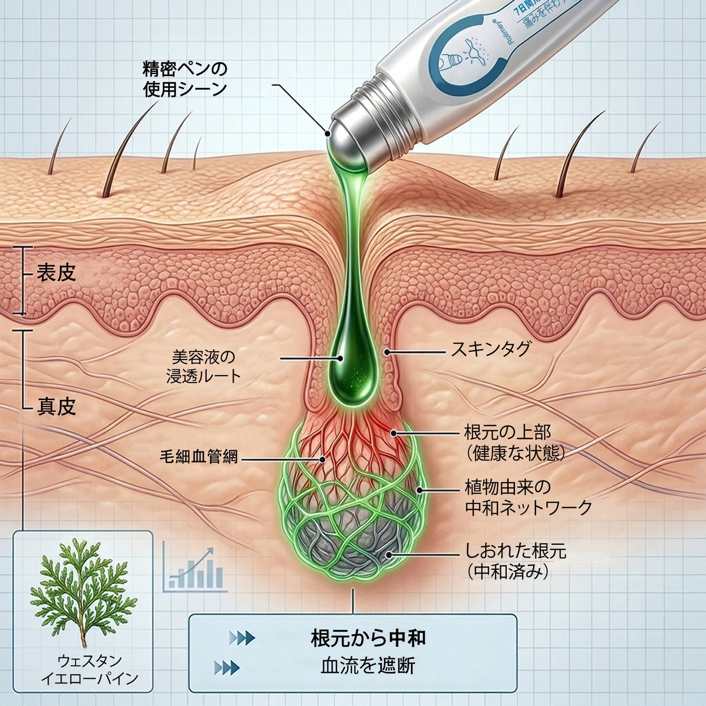 公式ショップ ✅｜GFOUK® 7日間集中ケア 肌のイボ・角質粒・シミのような色ムラケアに特化した美容パッチ👩‍⚕️ （痛みなし・傷跡なし・正確に塗布できるロールオンアプリケーター）🔥
