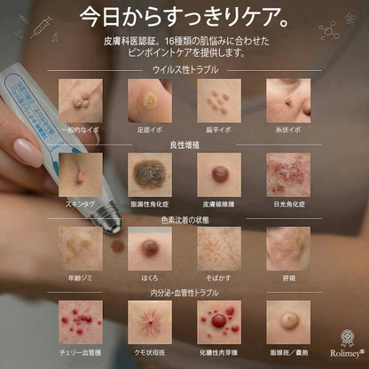 公式ショップ ✅｜GFOUK® 7日間集中ケア 肌のイボ・角質粒・シミのような色ムラケアに特化した美容パッチ👩‍⚕️ （痛みなし・傷跡なし・正確に塗布できるロールオンアプリケーター）🔥