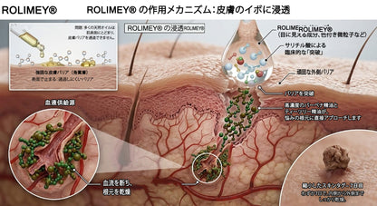 公式ショップ ✅｜GFOUK® 7日間集中ケア 肌のイボ・角質粒・シミのような色ムラケアに特化した美容パッチ👩‍⚕️ （痛みなし・傷跡なし・正確に塗布できるロールオンアプリケーター）🔥