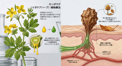 公式ショップ ✅｜GFOUK® 7日間集中ケア 肌のイボ・角質粒・シミのような色ムラケアに特化した美容パッチ👩‍⚕️ （痛みなし・傷跡なし・正確に塗布できるロールオンアプリケーター）🔥