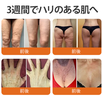 🧑‍⚕️DR. Fachmer®ビーベノム リペア再生クリーム🔥天然由来のエイジングケアで肌を引き締め、ハリを与え、乾燥による小ジワを目立たなくします – 50mL