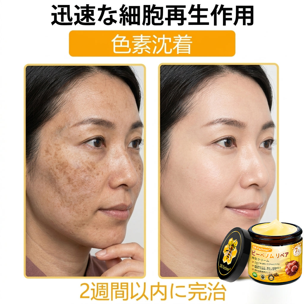 🧑‍⚕️DR. Fachmer®ビーベノム リペア再生クリーム🔥天然由来のエイジングケアで肌を引き締め、ハリを与え、乾燥による小ジワを目立たなくします – 50mL