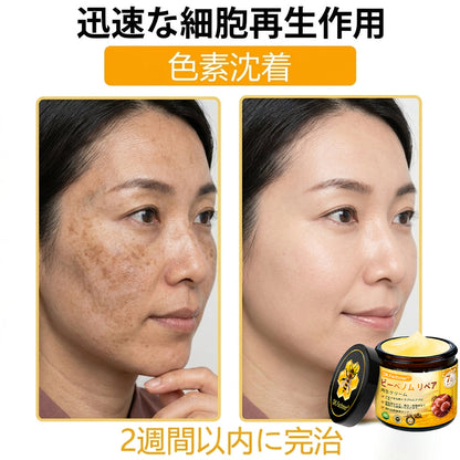 🧑‍⚕️DR. Fachmer®ビーベノム リペア再生クリーム🔥天然由来のエイジングケアで肌を引き締め、ハリを与え、乾燥による小ジワを目立たなくします – 50mL