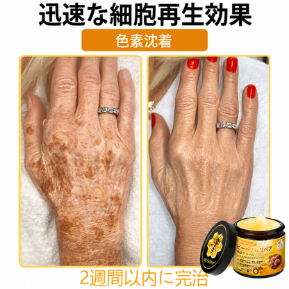 🧑‍⚕️DR. Fachmer®ビーベノム リペア再生クリーム🔥天然由来のエイジングケアで肌を引き締め、ハリを与え、乾燥による小ジワを目立たなくします – 50mL