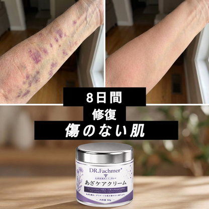 💜 累計販売数10万個突破 💁‍♀️DR. Fachmer® 打ち身・あざをケアし、肌をすこやかに整えるクリーム