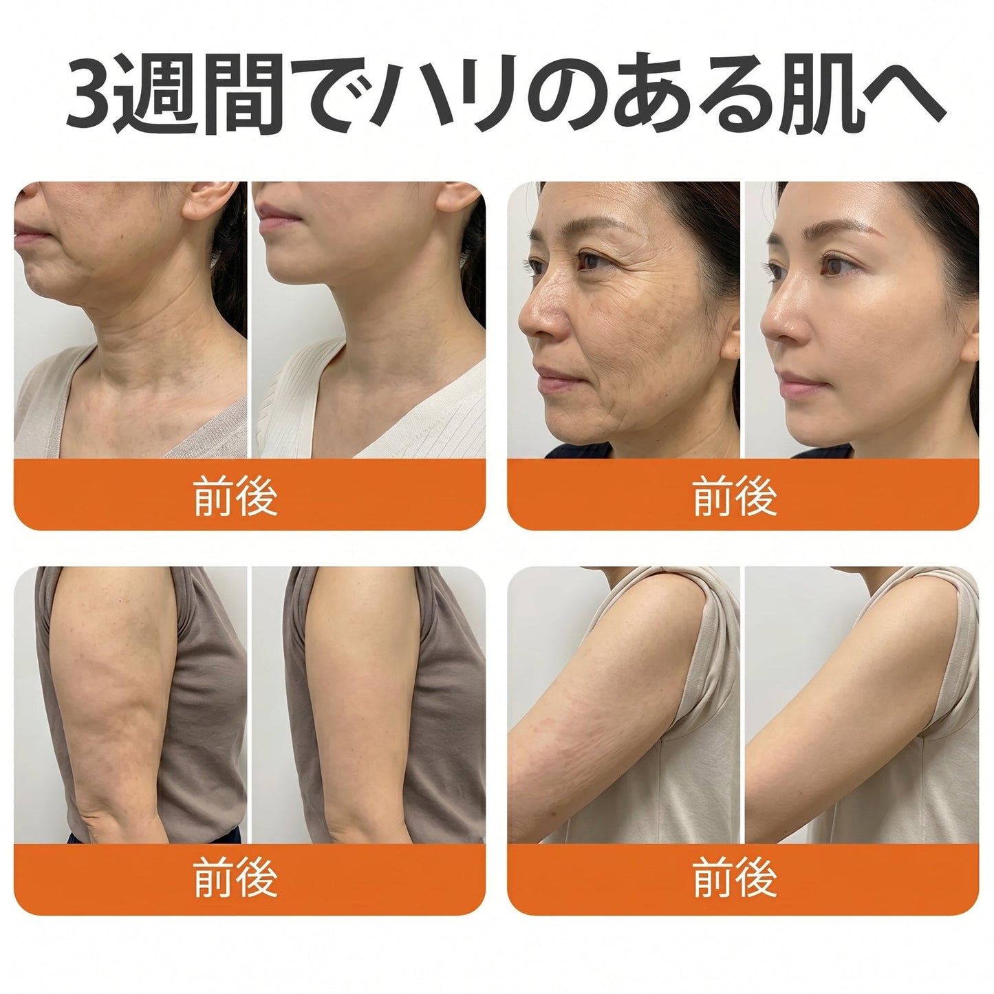 🧑‍⚕️DR. Fachmer®ビーベノム リペア再生クリーム🔥天然由来のエイジングケアで肌を引き締め、ハリを与え、乾燥による小ジワを目立たなくします – 50mL