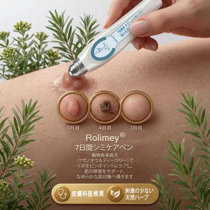 公式ショップ ✅｜GFOUK® 7日間集中ケア 肌のイボ・角質粒・シミのような色ムラケアに特化した美容パッチ👩‍⚕️ （痛みなし・傷跡なし・正確に塗布できるロールオンアプリケーター）🔥